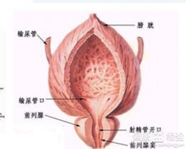 治療前列腺炎的最佳方法，治療前列腺炎的最佳方法解析