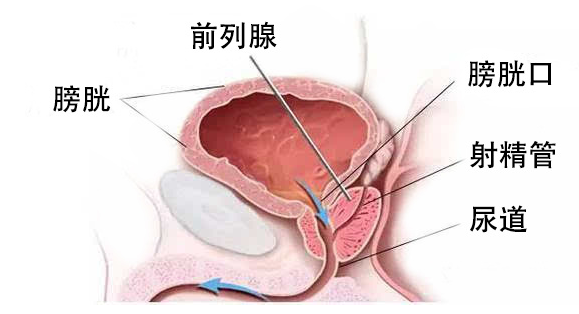 普樂安片治療前列腺炎的療程與效果，深度解析，普樂安片治療前列腺炎療程與效果深度解析，療程長短與治療效果一覽無余。