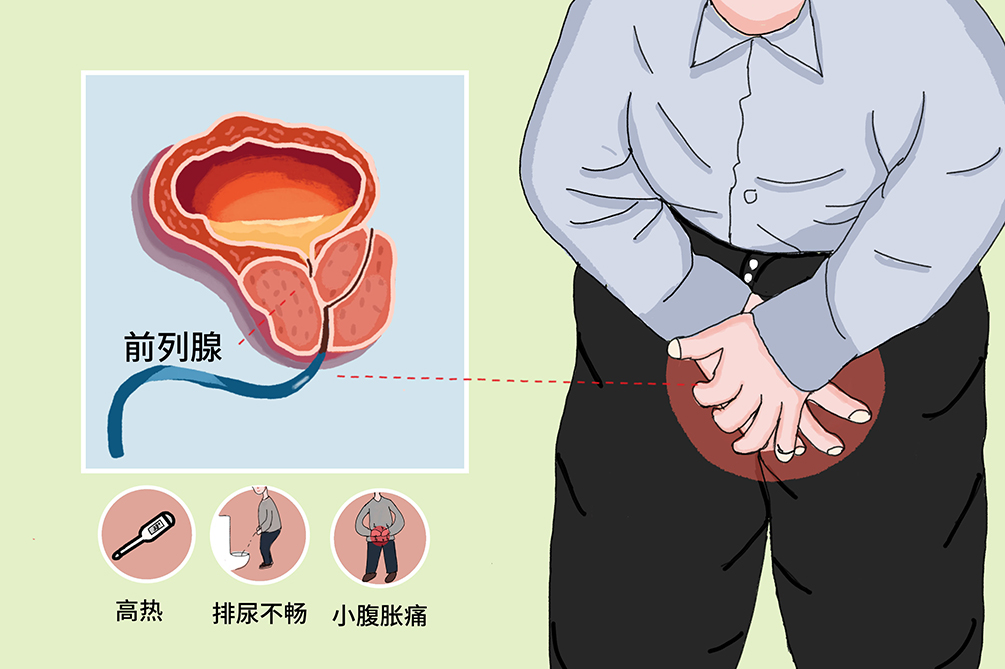 前列腺炎的緩解方法，了解、預(yù)防與改善，前列腺炎緩解方法，了解、預(yù)防與改善措施